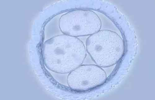 6个胚胎养囊成功率高吗？泰国试管婴儿医生进行专业解答！